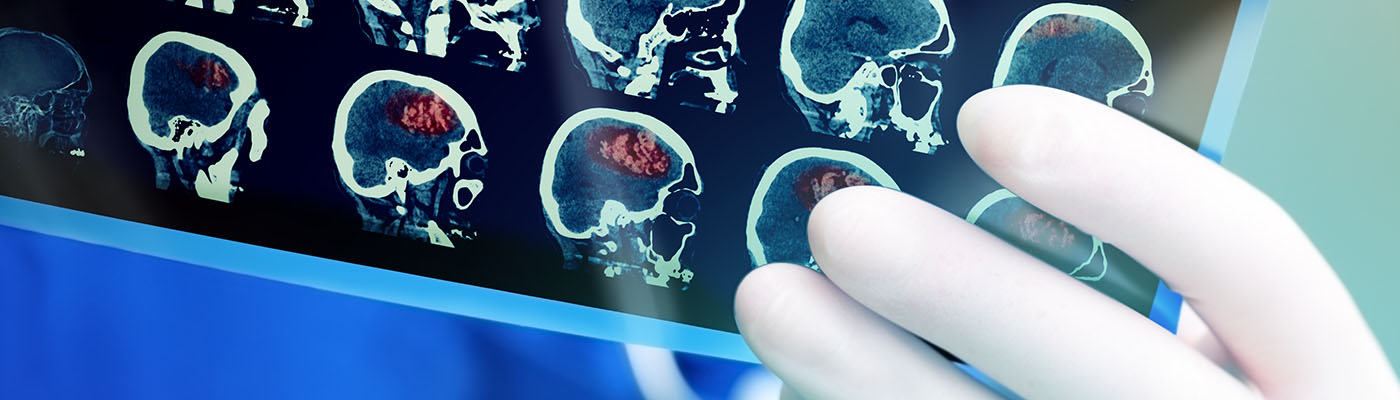 IMPaCT-midpage Doctor examining a MRI scan.